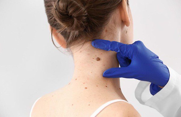 Revitag Review