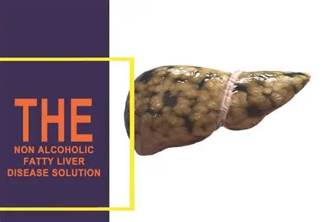 The Non Alcoholic Fatty Liver Disease Solution